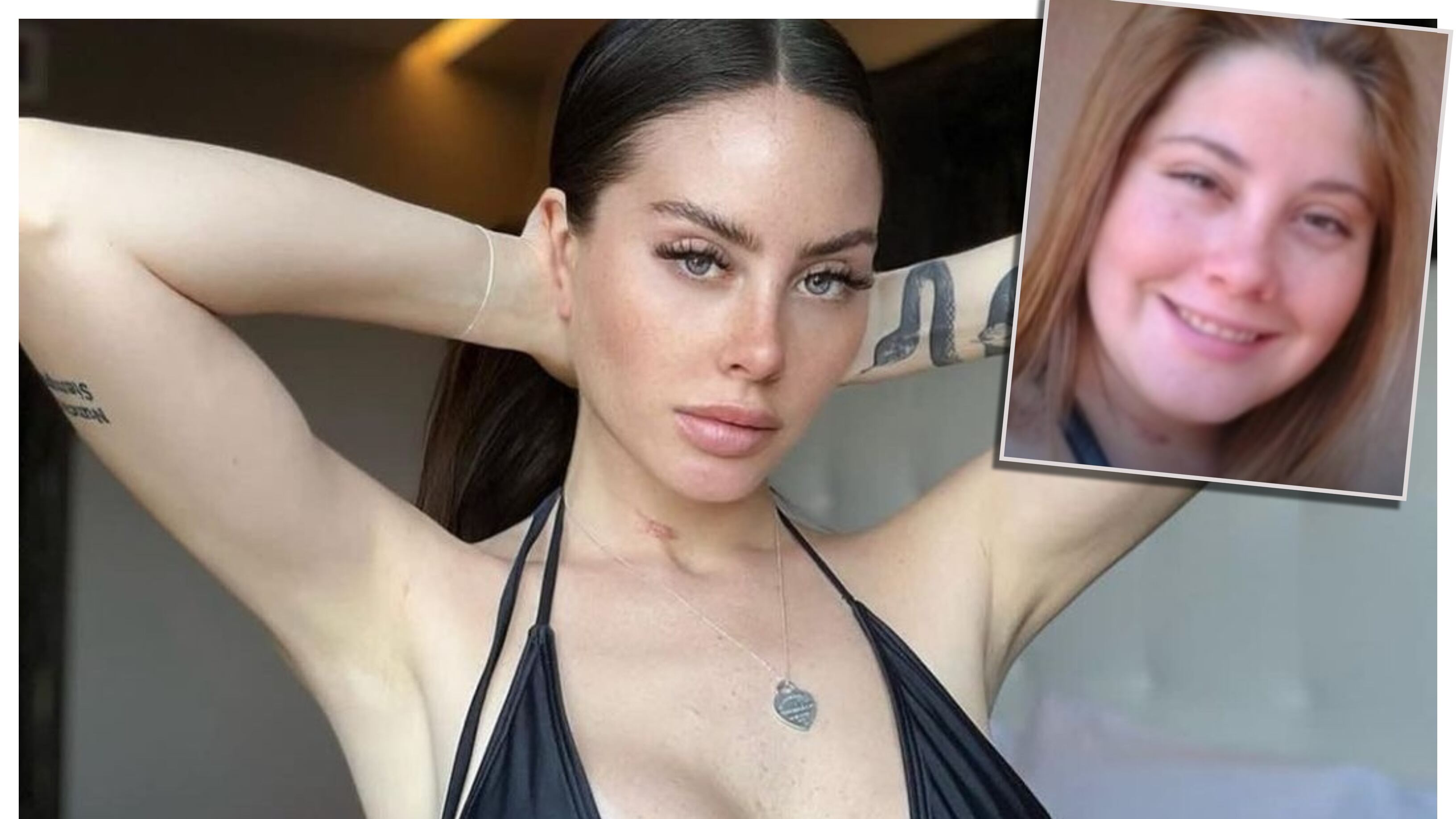 La influencer chilena contó de sus cirugías en entrevista con lun.com.