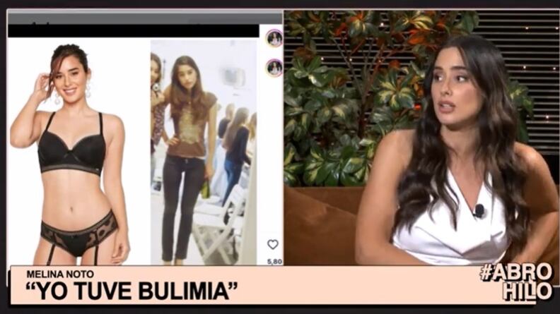 La modelo recordó en el programa de Felipe Cárdenas los problemas de salud que tuvo a raíz del trastorno alimenticia de bulimia que sufrió en su adolescencia.