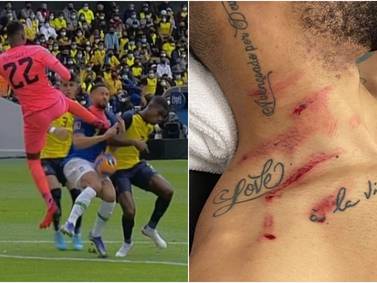 Matheus Cunha se ríe al mostrar las heridas en su cuello tras brutal patada de Domínguez: “Cómo lo explico en casa”